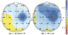 Increased use of brain reserves