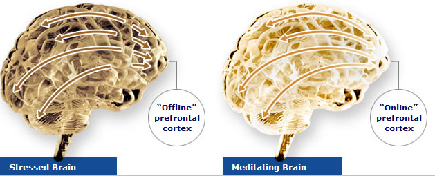 Brain