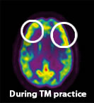 Frontal Lobes