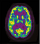 Thalamus