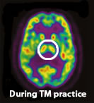 Thalamus